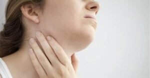 Nuevo León en foco rojo: repunte de paperas exhibe fallas en salud bajo Movimiento Ciudadano